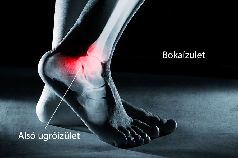 bokaízület fájdalma sérülés után