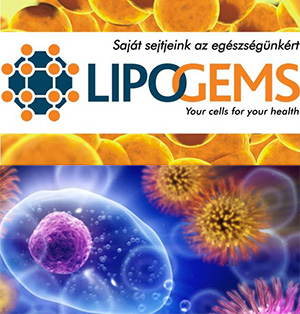 lipogems kezeles velemenyek)